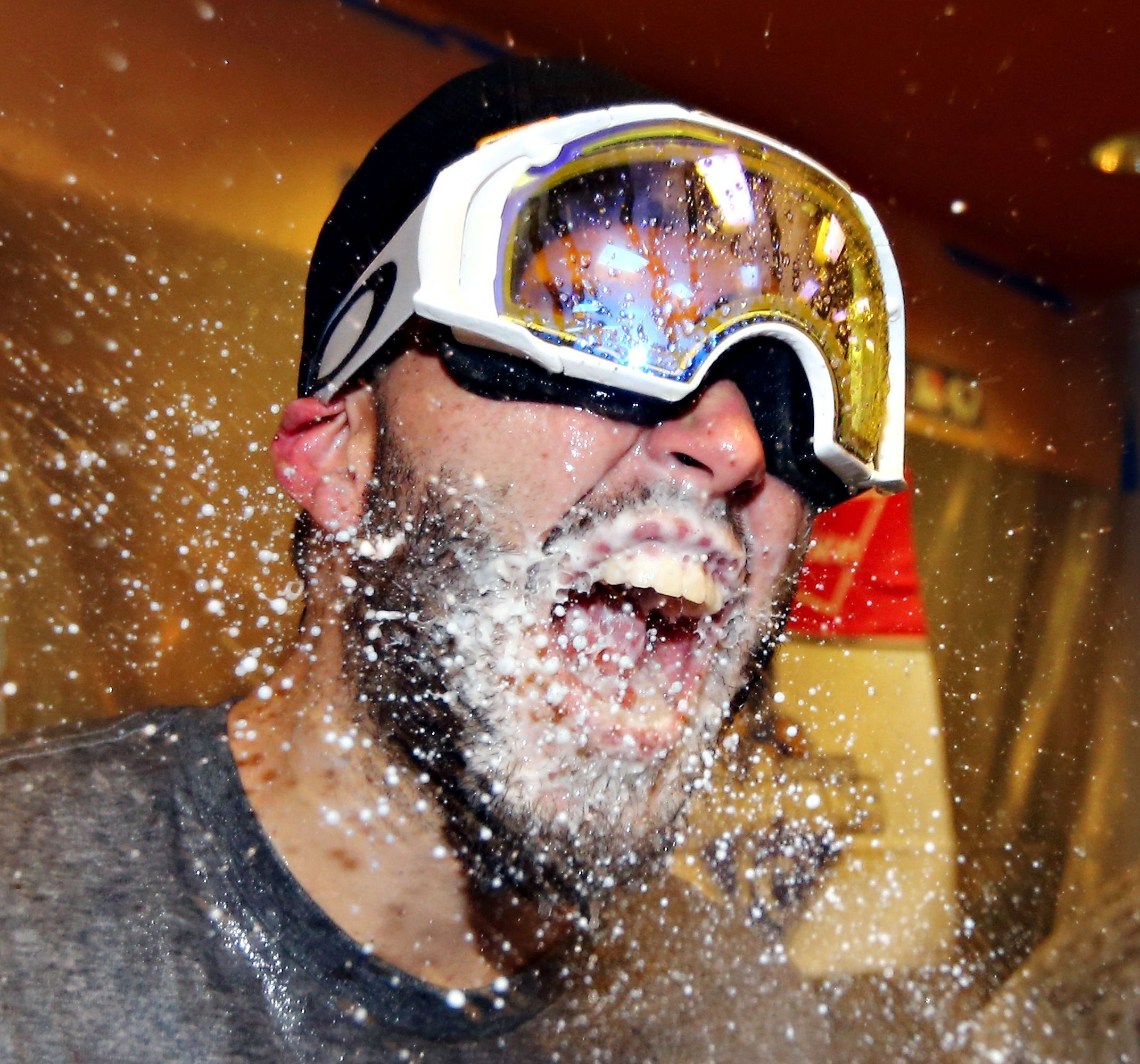 Hosmer y sus gafas protectoras