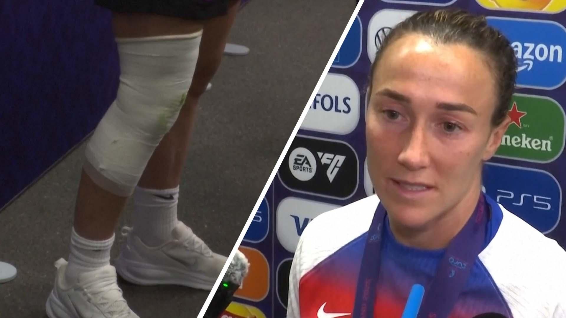 Inglaterra Campeona Euro 2025: La épica conquista y los secretos del triunfo 4 Bronze sobre el dolor de la fractura de pierna: Haré cualquier cosa para jugar por InglaterraLucy Bronze explica cómo jugó a pesar de una fractura de pierna para ayudar a Inglaterra a defender su corona de la Eurocopa.