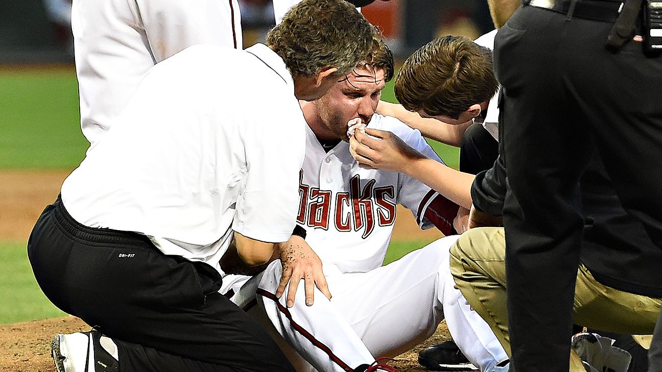 Archie Bradley suffers sinus cavity damage on line drive to face - ESPN