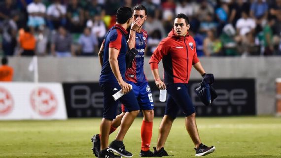Capitan Del Atlante Fuera Ocho Semanas Por Fractura En La Cara