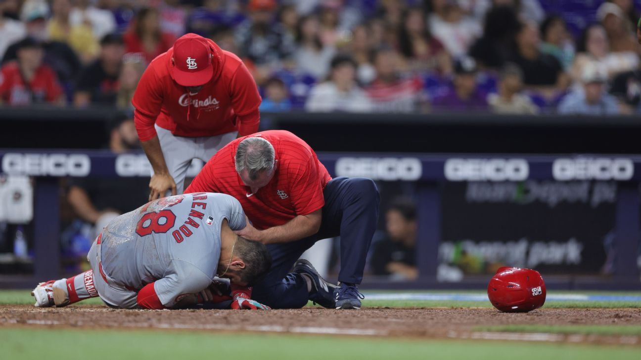 X-rays negative on Cardinals' Arenado after HBP