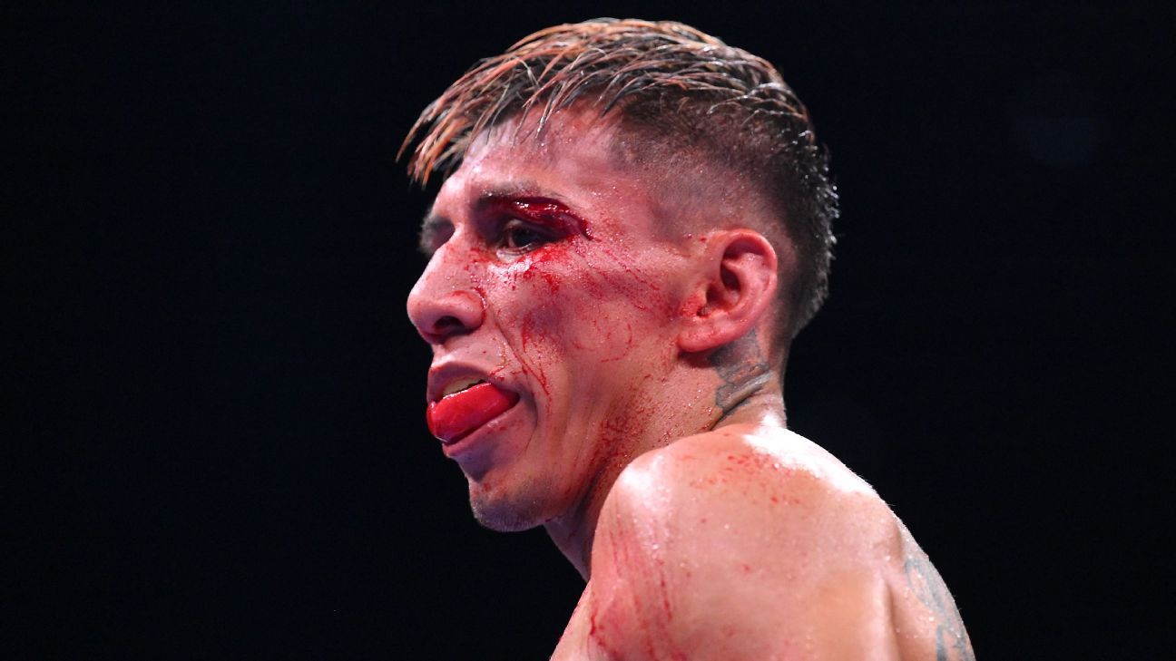 Rodriguez Jr.'s win vs. Yafai tainted by drug test